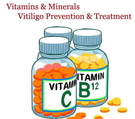 Vitamins and Minerals for Vitiligo: Evidence Levels, Doses, and What to Get Tested For